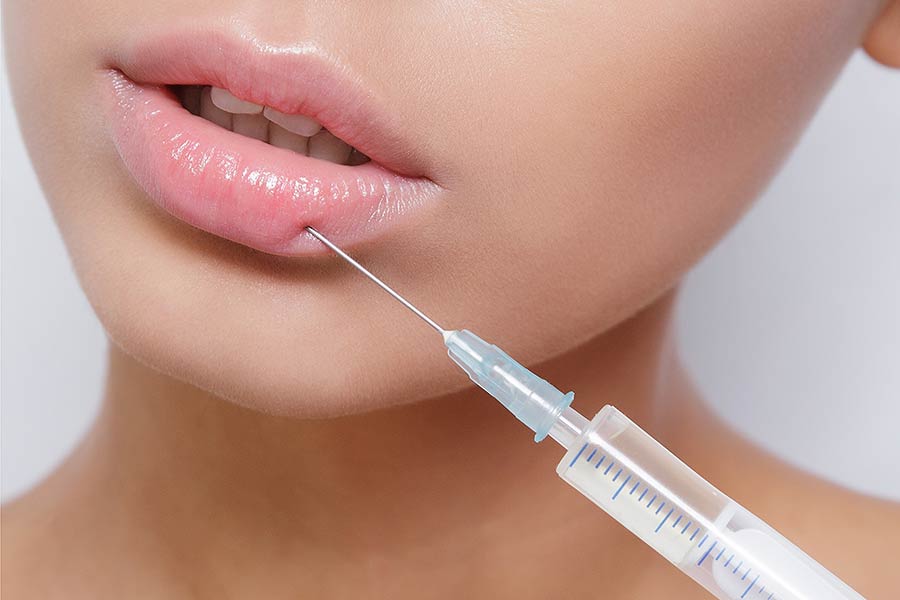 Lip Fillers: How Long Will My New Look Last?